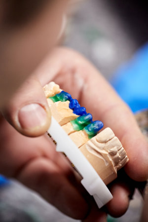 Dental technician dentist man working with dentures in his laboratory with wax and jaw model, close-up. Dental technician modeling tooth crowns with hot wax.の写真素材