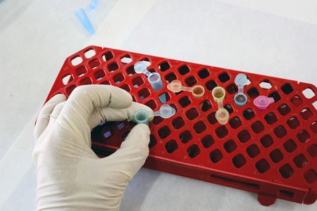 Color Microtubes in red rack