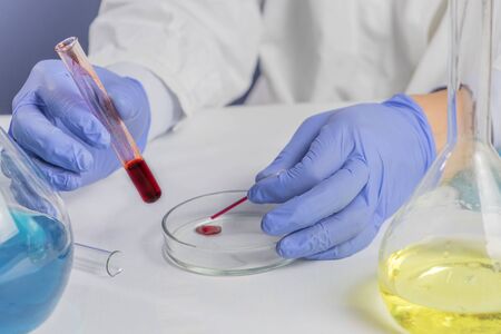 Male hands holding red blood whole blood in test tube for the sample. Health and medical, blood analyzing concept. Close up.の写真素材