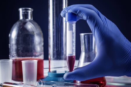 hand holding blood in test tube close up.の写真素材
