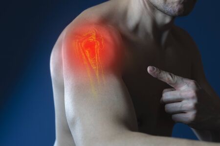 Photo a man points his hand to a sore shoulder, joint pain, side view, area of pain of red color