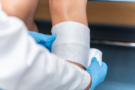 View of a doctor performing a bandage on the patient. Traumatology specialtyの写真素材
