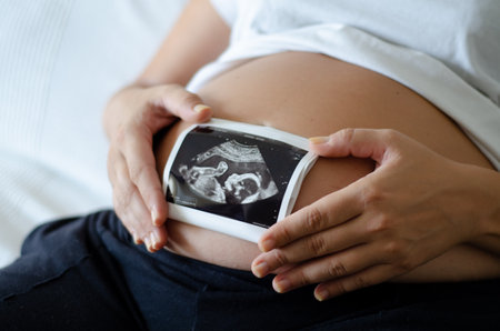 Pregnant woman holding ultrasound image of her baby. Pregnancy, maternity and expectation concept.の写真素材