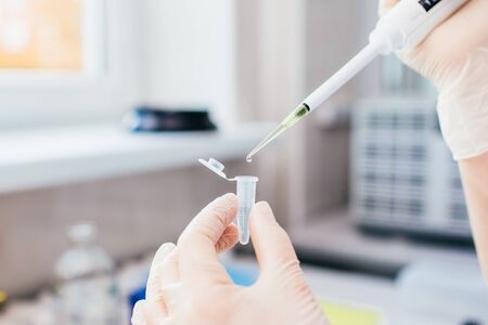 Pipette with several test tubes. Womans hand in white latex gloves in chemical laboratory filling...