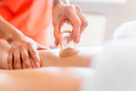 Masseur make massage with jars of cellulite on the buttock and thighs of patient. Treatment of excess weight, anti-cellulite, skin careの写真素材