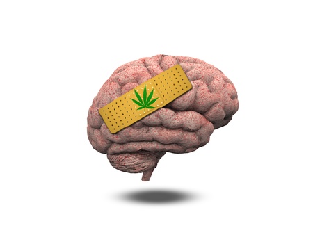 Wounded Brain with Marijuana Leafの写真素材