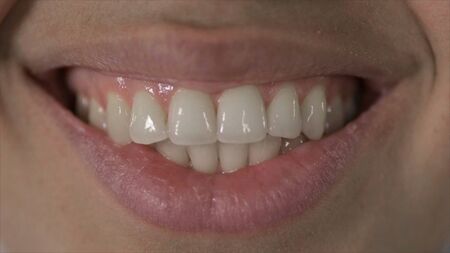 Close Up of African American Woman Teeth and Smiling