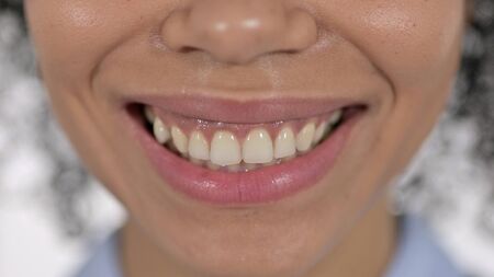 Lips and Teeth of Smiling Young African Womanの写真素材