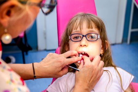 Portrait of sweet little girl with open mouth, glasses and carefree expression on her face during the dental check.の写真素材