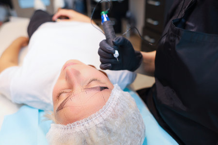 The client lies under the permanent eyebrow makeup procedure with a drawn sketch on his face, and the tattoo artist performs the procedure.の写真素材
