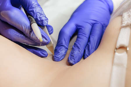 The electroepilation master sits opposite the client and prepares for the procedure for removing unwanted hairs using electricity.の写真素材