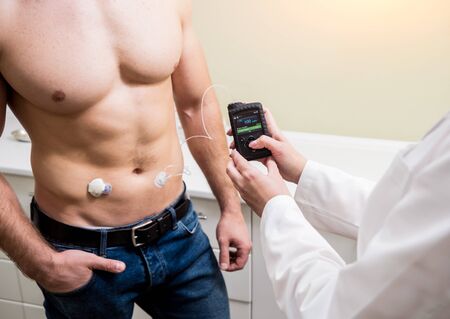 The doctor connects an insulin pump to a patient with diabetes. A concept of diabetes.の写真素材