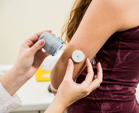Medical device for glucose check. Continuous glucose monitoring pod. Modern wireless technology.の写真素材