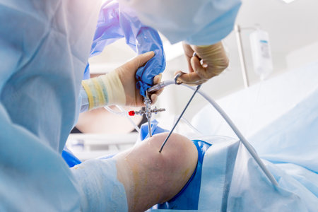 Arthroscope surgery. Orthopedic surgeons in teamwork in the operating room with modern arthroscopic...