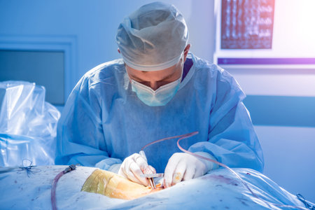 Spinal surgery. Group of surgeons in operating room with surgery equipment. Laminectomy. Modern...