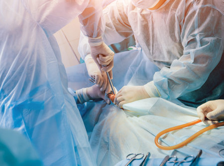 Process of gynecological surgery operation using laparoscopic equipment. Group of surgeons in...