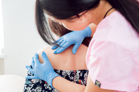 Doctor dermatologist examines birthmark of patient. Checking benign moles. Medical consultation