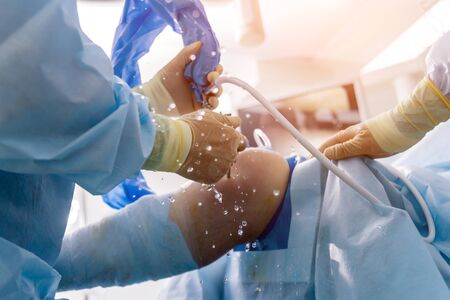 Arthroscope surgery. Orthopedic surgeons in teamwork in the operating room with modern arthroscopic tools. Knee surgery. Hospital backgroundの写真素材