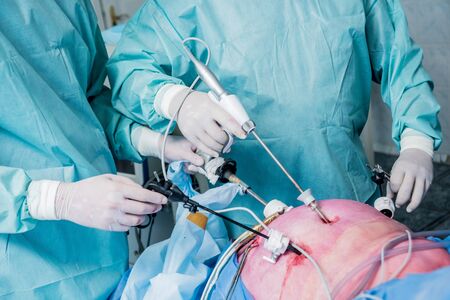 Process of gynecological surgery operation using laparoscopic equipment. Group of surgeons in operating room with surgery equipment. Medical backgroundの写真素材