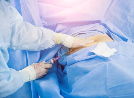 Arthroscope surgery. Orthopedic surgeons in teamwork in the operating room with modern arthroscopic tools. Hospital backgroundの写真素材