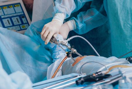 Process of gynecological surgery operation using laparoscopic equipment. Group of surgeons in operating room with surgery equipment. Backgroundの写真素材