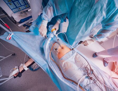 Process of gynecological surgery operation using laparoscopic equipment.の写真素材
