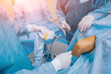 Arthroscope surgery. Orthopedic surgeons in teamwork in the operating room with modern arthroscopic tools. Knee surgery. Hospital backgroundの写真素材