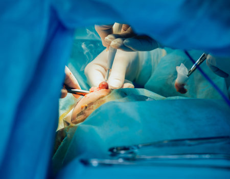Breast surgery in the operating room. Hospital