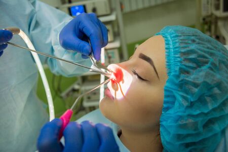 Endoscopic sinus surgery. Laser vaporization of nasal concha. Modern medical equipmentの写真素材