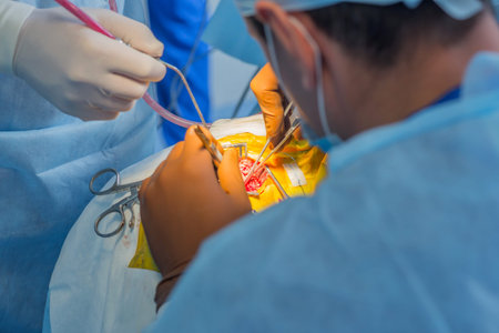 Brain surgery. Group of surgeons in operating room with surgery equipment. Modern medical background