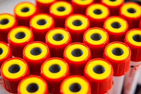 Medical equipment. Colored tubes. Medical light backgroundの写真素材