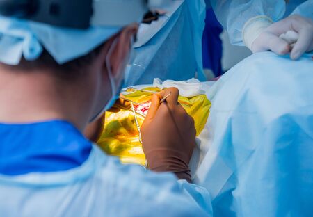 Brain surgery. Group of surgeons in operating room with surgery equipment. Modern medical backgroundの写真素材