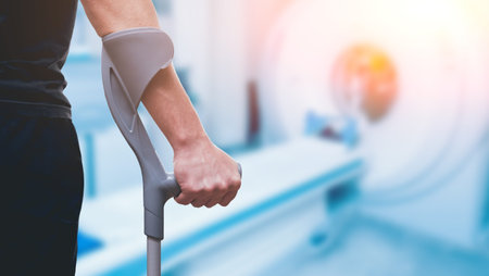 Injured man trying to walk on crutches. Blurred background