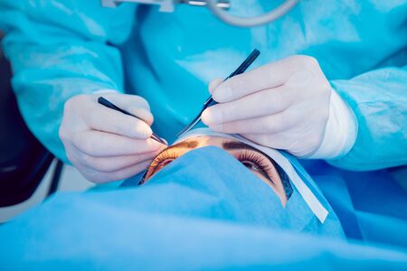 The operation on the eye. Cataract surgeryの写真素材