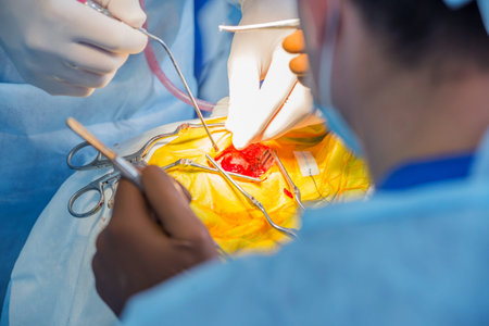 Brain surgery. Group of surgeons in operating room with surgery equipment.