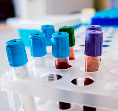 Medical equipment. Biochemistry test. Tubes and containers.