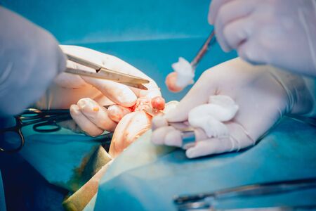 Breast surgery in the operating room. Hospitalの写真素材