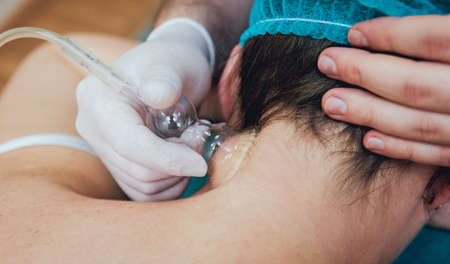 Vacuum massage. Medical procedure. The therapist massages the womans back.の写真素材