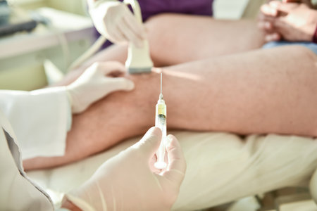 Ultrasound-guided platelet-rich plasma injection of the kneeの写真素材