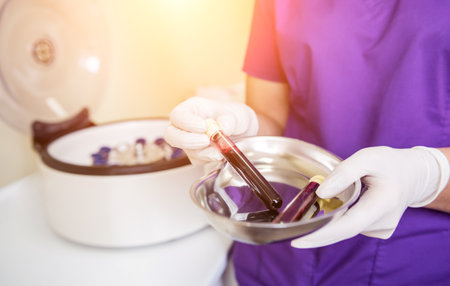 Platelet-Rich plasma preparation. Tube with blood in handsの写真素材