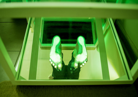 Doctor is at examining womans feet by using plantoscopy deviceの写真素材