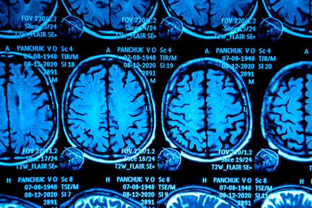 MRI scan of the brain. Magnetic resonance imaging scanの写真素材