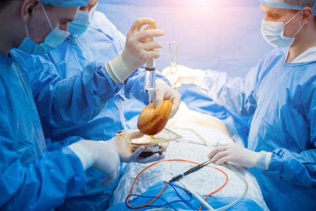 Breast augmentation under the guidance surgeons team in surgical operating room.