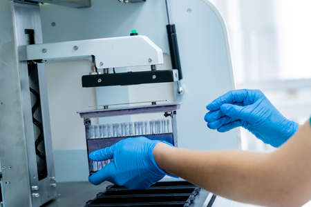 Laboratory assistant works with automatic multi slides stainer at the modern laboratory.の写真素材