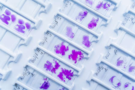 Rows of microscope glass slide in the cellsの写真素材