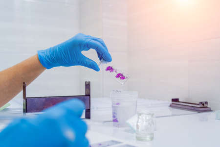 Hands in blue glove holding glass histology slidesの写真素材