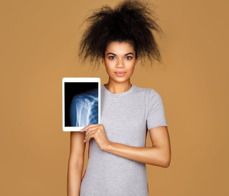 Girl shows the x-ray image of shoulder joint. Photo of young girl with tablet in her hands on beige...