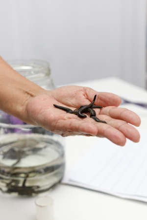 Medical leeches in hand against the background of a jar with medical leeches. Vertical. Selective soft focusの写真素材