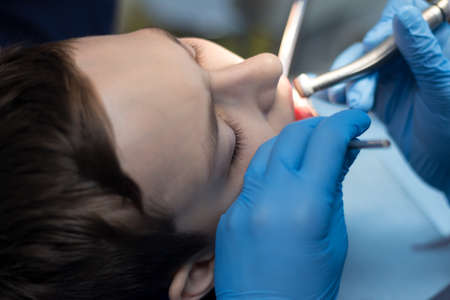 A teenager at a doctor's appointment is treating teeth. Hands of the dentist in blue gloves with tools close-up.の写真素材