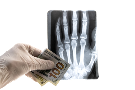 Concept hospital and expensive treatment, health and finance, medicine and corruption. A medic or laboratory worker in a glove holds an X-ray of a hand through one hundred US dollars on a white background. Isolateの写真素材